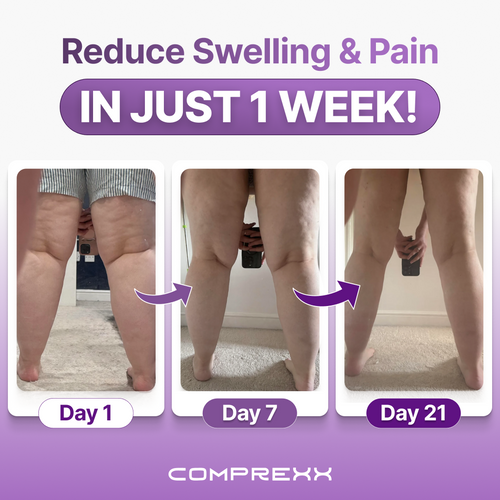 Comprexx Advanced Wide Compression Socks